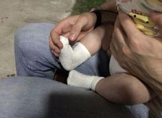 a man holding a baby with a cast on it's leg while sitting down