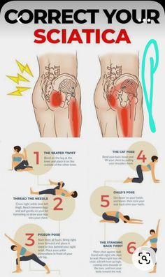 a poster with instructions on how to correct sciatica