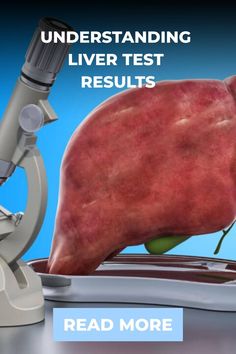 Learn how to interpret your liver test results, including key indicators like ALT, AST, and bilirubin levels. This guide helps you understand what normal and abnormal results mean, offering insights into liver function and potential health concerns.