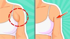 a woman's breast is shown with an arrow pointing to the right and left side