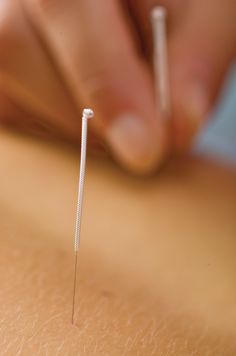 Acupuncturist Aesthetic, Acupuncture Aesthetic, Acupuncture Needle, Body Massage Spa, Vision Board Book, Eastern Medicine, Biology Facts, Health Trends