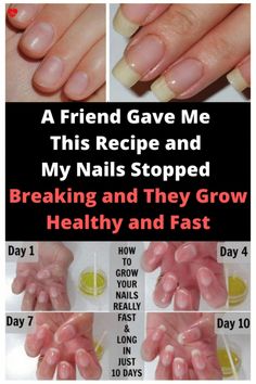 A FRIEND GAVE ME THIS RECIPE AND MY NAILS STOPPED BREAKING AND THEY GROW HEALTHY AND FAST Make Nails Grow, Grow Long Nails, Nail Growth Tips, Natural Nail Care, Health Signs, Tongue Health, Nagel Tips, Nail Care Tips, How To Grow Nails