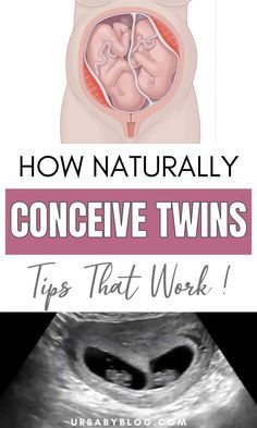 an image of how naturally conceive twins work