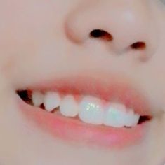 Smile Claim For Dr, Teeth Claim, Canine Teeth Human Aesthetic, Smile With Fangs, Shifting Claims, Custom Phone Cases Diy, Smile Tips, Cute Teeth, Canine Teeth