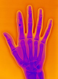 an image of a hand that is purple