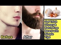 Get Thick, Beards And Mustaches, Mens Hairstyles With Beard, Hair Care Remedies