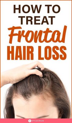 Hair Shedding Remedies, Natural Hair Growth Remedies, Stop Hair Breakage, Frontal Hair, Receding Hairline, Brown Spots On Face, Hair Growth Supplement, Home Remedies For Hair, Regrow Hair