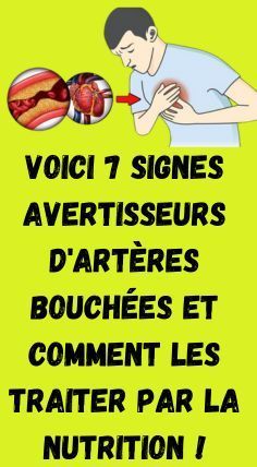 Voici 7 signes avant-coureurs d’artères bloquées Lower Blood Sugar Naturally, Healthy Facts, Daily Health Tips, Good Health Tips