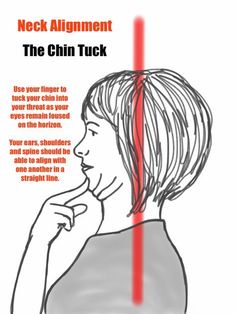 Chin Tuck Exercise, Prehab Exercises, Chin Tuck, Migraine Triggers, Natural Headache, Neck Muscles