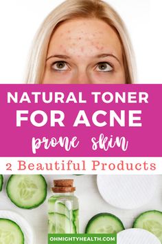 In terms of having to find appealing natural toners for acne / acne-prone skin HAS NOT been an easy task. I’m fussy. I look for brands that only add natural ingredients to their products (organic even better) and also products that don’t have any fragrance/perfume (what’s in them?). Anti Acne Diet, Natural Face Toner, Skincare For Acne, Acne Diet, Acne Products, Natural Toner, Oily Face