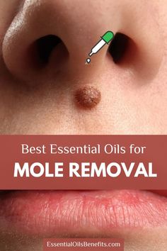 Looking for a natural solution to remove moles? Discover the best essential oils for mole removal and how to use them safely at home. #MoleRemoval #EssentialOils #NaturalRemedies #Skincare Remove Moles, Essential Oils For Congestion, Essential Oils For Cough, Oils For Sore Throat, Relaxing Essential Oils, Essential Oils For Pain, Essential Oils For Headaches, Essential Oils For Kids, Oils For Sleep