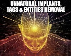 a man's head with the words unnatural implants, tags and entitled removal