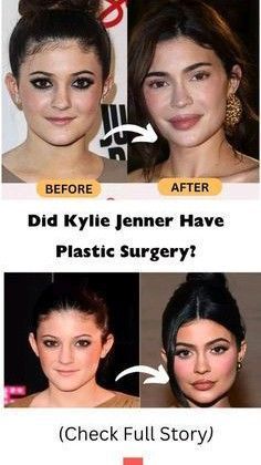 Plastic Surgery Fails, Skincare Aesthetics, Doctor Medicine, Surgery Doctor, Hospital Health