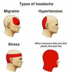 different types of bald men with their names in english and spanish on each side of the head