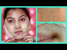 Remove Unwanted Facial Hair, Blackheads & Whiteheads at Home/get clear skin/orange peel off mask - YouTube Vaseline Eyebrows, Skin Cleanser Diy, Get Clear Skin, Remove Unwanted Facial Hair, Charcoal Face Mask, Green Tea Mask, Unwanted Facial Hair, Proper Skin Care, Mask Diy