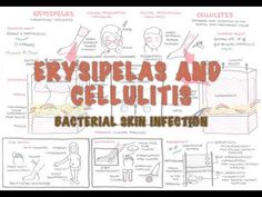 Bacterial Skin Infection - Cellulitis and Erysipelas (Clinical Presentat... Armando Hasudungan, Bacterial Diseases, Throat Infection, Face Pores, Eye Infections, Sinus Infection, Medical Knowledge, Skin Diseases