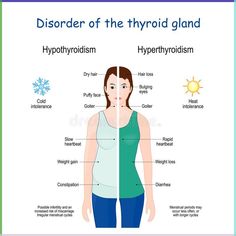 Hyperthyroidism and Hypothyroidism. Female with Signs and symptoms of different thyroid gland diseases. Illustration about graves, female, endocrinology, gland, diagram - 192782449 Diseases Illustration, Thyroid Levels, Irregular Menstrual Cycle, Thyroid Test, Healthy Book, Low Thyroid, Thyroid Medication, Thyroid Function, Thyroid Gland