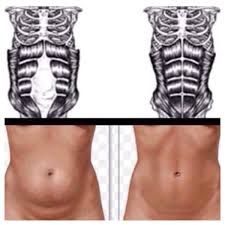 Image result for diastasis recti exercises- I never heard of this until after my twin pregnancy. Diástase Abdominal, Modele Fitness, Mommy Workout, Post Pregnancy