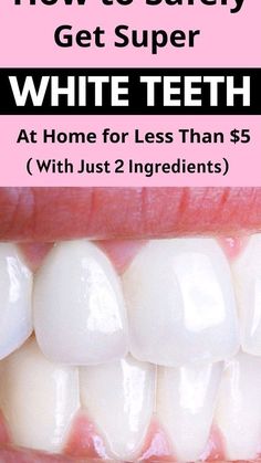 This rare picture taken in a dentist’s office reveals that an extremely dangerous bacterium is growing on your gums at this very moment. Tooth Pain Relief, At Home Teeth Whitening, Home Teeth Whitening