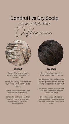 They may look similar – white flakes in your hair and on your clothing – but the difference between dandruff and dry scalp is real. There’s more to managing these common scalp conditions than simply using a dandruff shampoo. Dandruff Solutions, Home Remedies For Dandruff, Dandruff Flakes, Shampoo For Dry Scalp, Head Spa, Dandruff Remedy, Hair Dandruff, Scalp Scrub