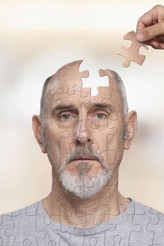 Cognitive test - What Is Mild Cognitive Impairment? Memory Artwork Inspiration, Implicit Memory, Disease Art, Alzheimer's Illustration, Memory Illustration, Alzheimer Brain Scan, Cognitive Impairment, Memory Test