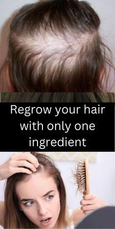 Regrow your hair with only one ingredient!!🔥 Hair Fall Control Tips, Thicker Healthier Hair, Hair Growth Foods, Lush Forest, Organic Hair Care, Natural Hair Care Tips, Hair Remedies For Growth, Healthier Hair