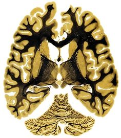 an image of the human brain showing different areas of the nervous system, including the cerebratorys