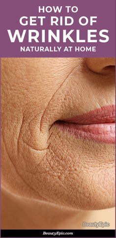 Home Remedies For Wrinkles, Smokers Lines, Cover Wrinkles, Get Rid Of Wrinkles, Lip Wrinkles, Forehead Wrinkles