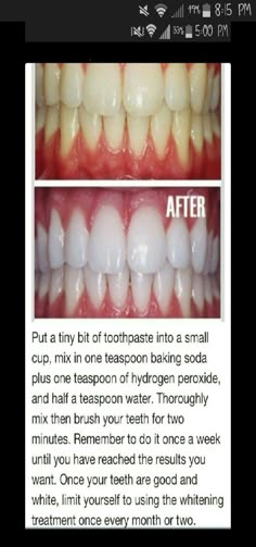 Diy Teeth, Teeth Whitening Remedies, Teeth Whitening Diy, Diy Teething, Oral Care Routine, Natural Teeth Whitening, Natural Teeth, Oral Health Care, White Teeth