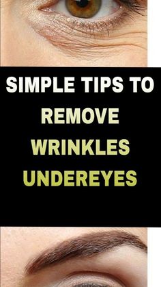 SIMPLE TRICK TO REMOVE WRINKLES UNDER EYES Wrinkles Under Eyes, Antiaging Skincare, Extra Virgin Coconut Oil, Under Eye Wrinkles