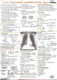 the chest radiograph interpretation skill sheet for students to use in their classroom workbook