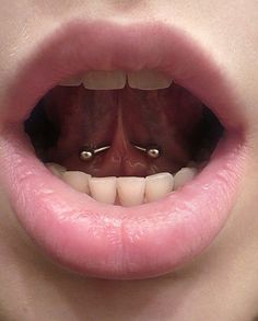 a woman's mouth with two piercings on the top and bottom of her teeth