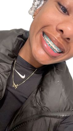 Braces Color Power Chain, Braces Without Power Chain, Black Braces Power Chain, Teal Power Chain Braces, Black Power Chain Braces, Braces Colors Ideas Power Chains, Power Chain Braces Colors, Aesthetic Braces