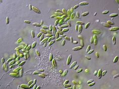 an image of some green algaes under microscope glass with water droplets on the surface