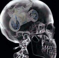 an x - ray image of a skeleton with a motorcycle on it's head