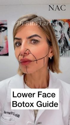 Thread Lift Face, Botox Training, Neck Lines, Thread Lift, August 21, Anti Aging, Health And Beauty