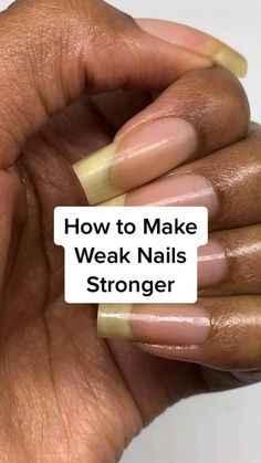 Nails Stronger, Sunburn Remedies, Weak Nails, How To Grow Nails