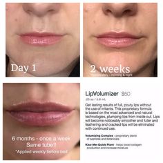 Cracked Lips, Lip Plumper, Beauty Skin, Make Up, Skin Care, Lips