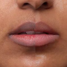 Lip Hyperpigmentation, Lip Neutralization, Lip Pigmentation, Brown Nail, Lip Gloss Balm, Bright Lips