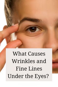 WHAT CAUSES WRINKLES AND FINE LINE UNDER THE EYES Wrinkle Under Eyes Remedies, What Causes Under Eye Bags, Hydrate Under Eyes, Wrinkles Around The Eyes, Wrinkles Under Eyes Get Rid Of, How To Remove Wrinkles Under Eyes, How To Tighten Under Eye Skin, How To Get Rid Of Eye Wrinkles, How To Get Rid Of Fine Lines Under Eyes