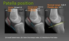 the knee is shown with different types of pain