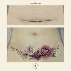 the before and after pictures of a woman's stomach with flowers on her side