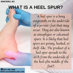 A heel spur is a bony outgrowth on the underside of a person's foot that may occur. They are also known as osteophytes or calcaneal spurs. It is likely that heel spurs are pointy, hooked, or shelf-like. The product of a heel spur spreads to the arch from the underside of the heel (the middle of the foot). Our healthcare team works with patients to find both the source of pain, and how to best provide relief. Check our website here - .https://www.adamsewellmd.com/typical-home-page . #Wellne Bone Spur Heel, Calcaneal Spur, Massage Pics, Food Health Benefits