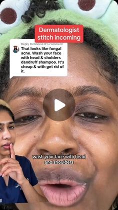 Forehead Acne Home Remedies, Forehead Acne Remedies, Head And Shoulders For Acne, Tiny Bumps On Face, Tiny Bumps On Forehead, Acne On Forehead, Forehead Acne Cause, Dry Forehead, Forehead Breakout