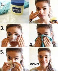 This is one multitasking beauty product for sure. Beauty Infographic, Blackheads Removal Cream, Blackhead Remedies, Skin Cleaning, Blackheads On Nose, Rid Of Blackheads, Facial Treatments, Get Rid Of Blackheads, Hair Follicles