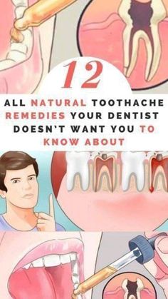 Toothache Remedies, Remedies For Tooth Ache, Dental Health Care, Health And Hygiene, Motivational Fitness Quotes, Hygiene Care, Periodontal Disease, Oral Care Routine