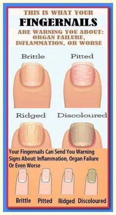 Fingernails Warning You by Rachel Thomson | This newsletter was created with Smore, an online tool for creating beautiful newsletters for educators, businesses and more Healthy Fingernails, Fingernail Health, Nail Signs, Split Nails, Nail Conditions, Brittle Nails, Health Tips For Women