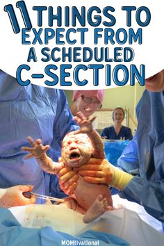 a baby being held up in an inclosure with the caption saying things to expect from a scheduled c - section