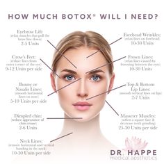 Facial Botox Areas, Botox Areas On Face, Botox For Sweating, Natural Skin Tightening, Facial Procedure