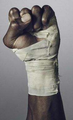 a hand with bandages wrapped around it's wrist and thumb in the middle of its fist